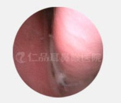 ������ڿ���ͼ